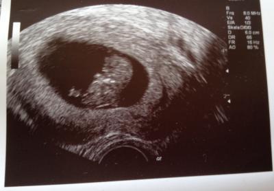 Bild zu außerplanmäßiger FA-Besuch - Forum für Mai - Mamis