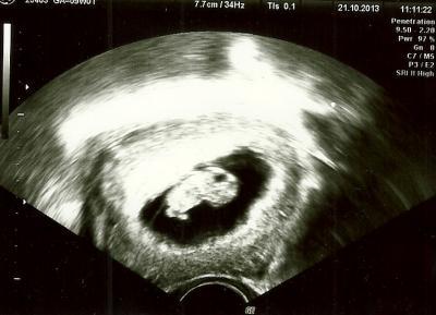 Bild zu Zurück vom Arzt - Forum für Mai - Mamis