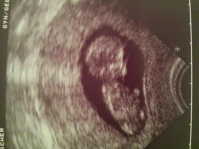 Bild zu Gestern war es wieder so weit.... - Forum für Mai - Mamis