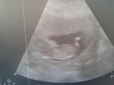 Bild zu Zurück vom FA - Forum für Mai - Mamis