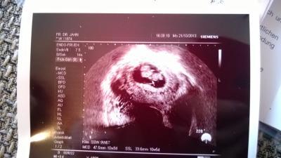 Bild zu Warten , warten , warten ... - Forum für Mai - Mamis