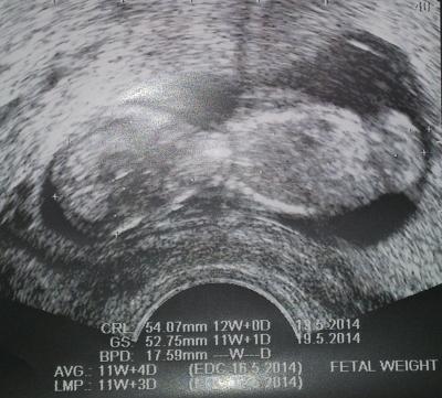 Bild zu FA-Bericht - Forum für Mai - Mamis