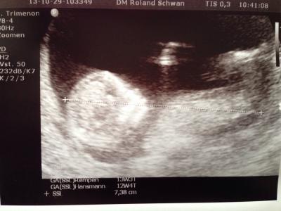 Bild zu FA heute - Forum für Mai - Mamis