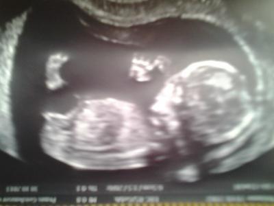 Bild zu bericht frauenarzt :0) - Forum für Mai - Mamis