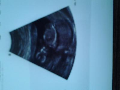 Bild zu Fa Bericht und vorsichtiges outing ♥♡ - Forum für Mai - Mamis