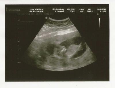 Bild zu VU gehabt - Forum für Mai - Mamis