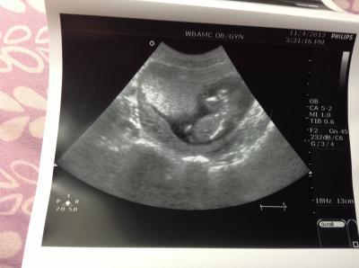 Bild zu Fa Bericht - Forum für Mai - Mamis