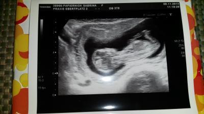 Bild zu Frauenarzt Termin (: - Forum für Mai - Mamis