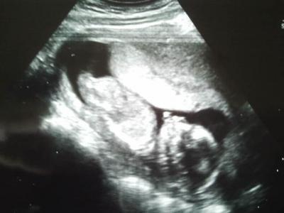 Bild zu FA-Termin - Forum für Mai - Mamis