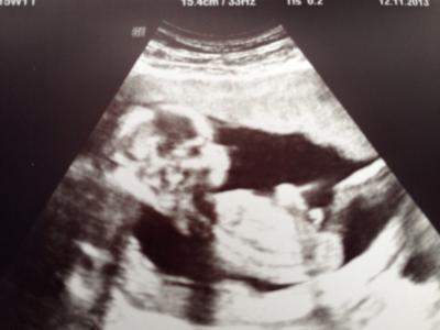 Bild zu Bildchen vom Goldschatz ;-) - Forum für Mai - Mamis