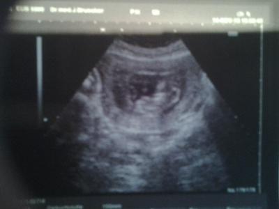 Bild zu Sorry, völlig verspäteter FA Bericht...... - Forum für Mai - Mamis