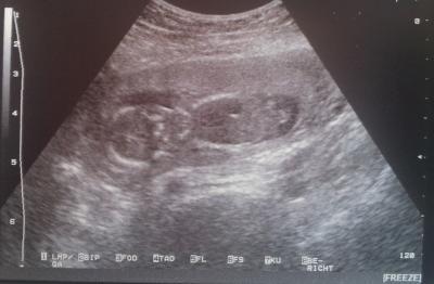 Bild zu Montag FA-Termin - Forum für Mai - Mamis