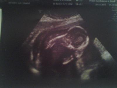 Bild zu noch ein babyfoto von donnerstag beim doc :0) - Forum für Mai - Mamis