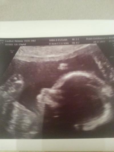 Bild zu zurück vom FA - Forum für Mai - Mamis