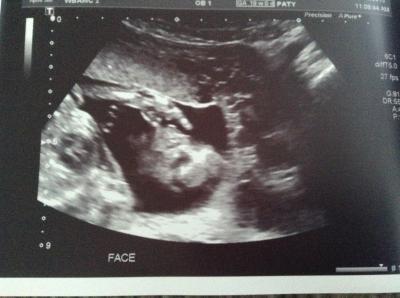 Bild zu Organscreening und outing - Forum für Mai - Mamis