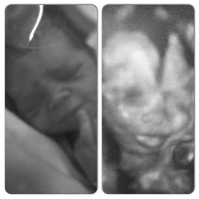 Bild zu Organscreening, Outing und ein kleiner Tiefschlag - Forum für Mai - Mamis