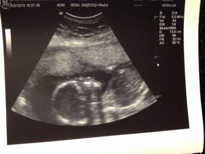 Bild zu 20.SSW - Forum für Mai - Mamis