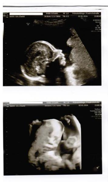 Bild zu Bericht FD nach Whitespot-Fund - Forum für Mai - Mamis