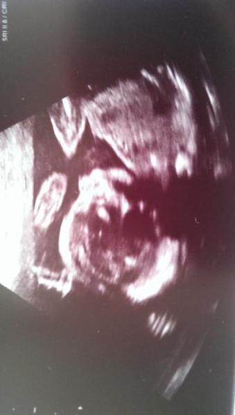 Bild zu Ein Bild :) - Forum für Mai - Mamis