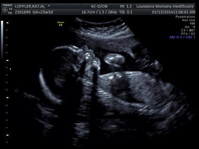 Bild zu US, FA, Geburtshaus, Shopping - und BILD :D - Forum für Mai - Mamis