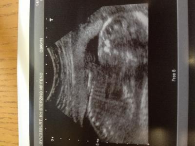 Bild zu Fa Bericht - Forum für Mai - Mamis