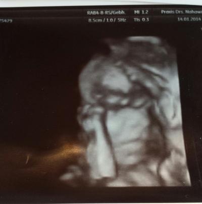 Bild zu 2. Screening + Foto :) - Forum für Mai - Mamis