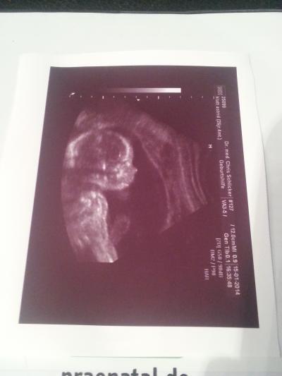 Bild zu Ultraschall und Outing bei 20+6 - Forum für Mai - Mamis