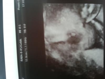 Bild zu sooo fertig vom doc :0) - Forum für Mai - Mamis