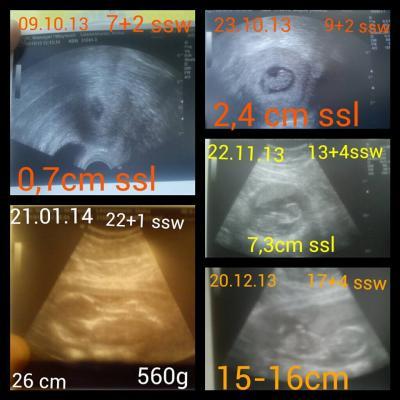 Bild zu Mal wieder melden / Bericht 2 Screening / Bildercollage - Forum für Mai - Mamis