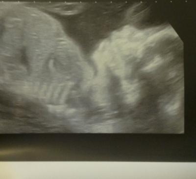 Bild zu nach 5 Wochen :) - Forum für Mai - Mamis