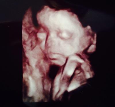 Bild zu Kindslage? - Forum für Mai - Mamis