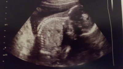 Bild zu Moin! - Forum für Mai - Mamis