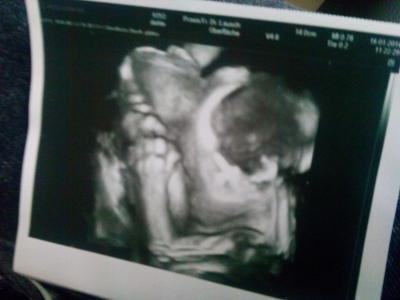 Bild zu Soo..Das ist meine Maus:-) - Forum für Mai - Mamis