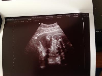 Bild zu Zurück vom Doc - Forum für Mai - Mamis