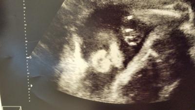 Bild zu Heutiger Arzttermin - Forum für Mai - Mamis