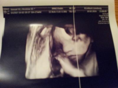 Bild zu 3D Ultrachall und FA Kontrolle - Forum für Mai - Mamis