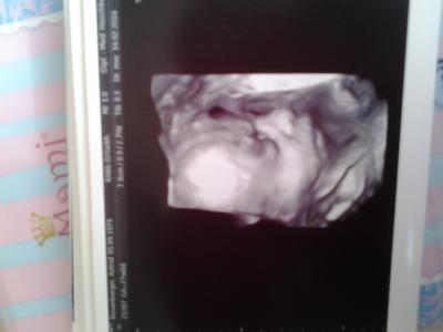 Bild zu Bericht Feindiagnostik - Forum für Mai - Mamis