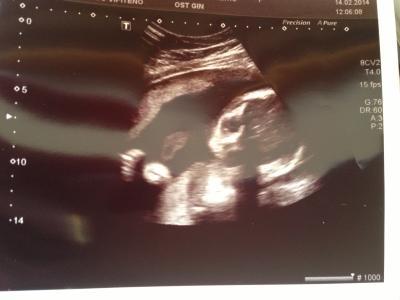 Bild zu FA-Termin - Forum für Mai - Mamis