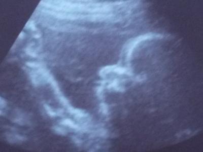 Bild zu Turnstunde beim FA - Forum für Mai - Mamis