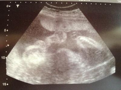 Bild zu Fa Bericht + Outing - Forum für Mai - Mamis