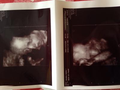 Bild zu Zurück vom FA - Forum für Mai - Mamis