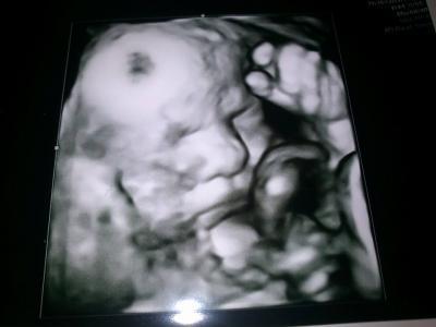 Bild zu Termin heute :) - Forum für Mai - Mamis