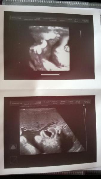 Bild zu Ich bin verliebt,..... Tollster FA Termin überhaupt... - Forum für Mai - Mamis