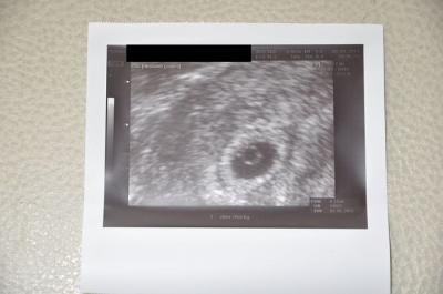 Bild zu zurück vom FA... - Forum für Mai - Mamis