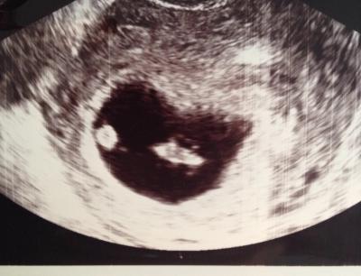 Bild zu Auch zurück vom FA - mit Foto :) - Forum für Mai - Mamis