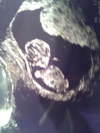 Bild zu Und noch ein Bild :) - Forum für Mai - Mamis