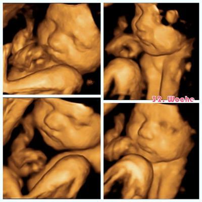 Bild zu 3D Babykino < 3 - Forum für Mai - Mamis