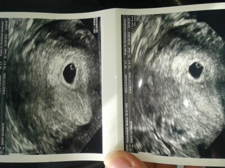 Bild zu erster Ultraschall - Forum für Mai - Mamis