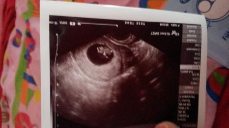 Bild zu Eure letzten Ultraschall Bilder - Forum für Mai - Mamis
