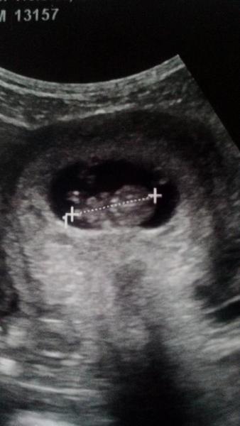 Bild zu Baby Bild đ - Forum fĂŒr Mai - Mamis